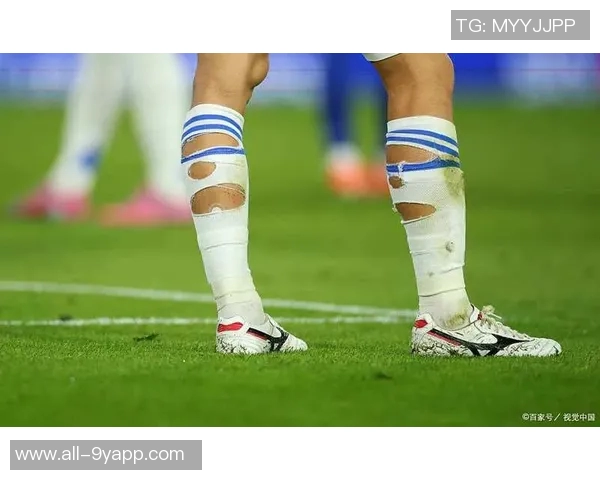 马德里竞技官方宣布朗格莱遭遇重度内侧副韧带扭伤无其他损伤